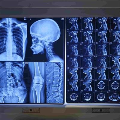 Konvencionalni rendgenski film